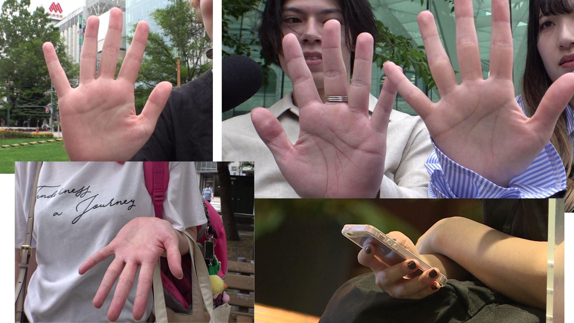 スマホ 小指 変形